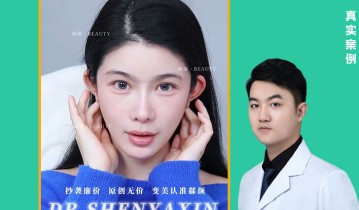 𝐃𝐫 ·沈亚鑫院长 微调的权威～打造骨相高级脸案例